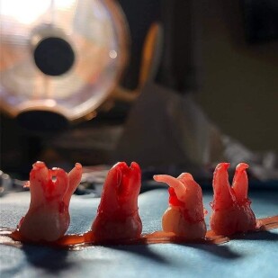 جراحی های دندانی